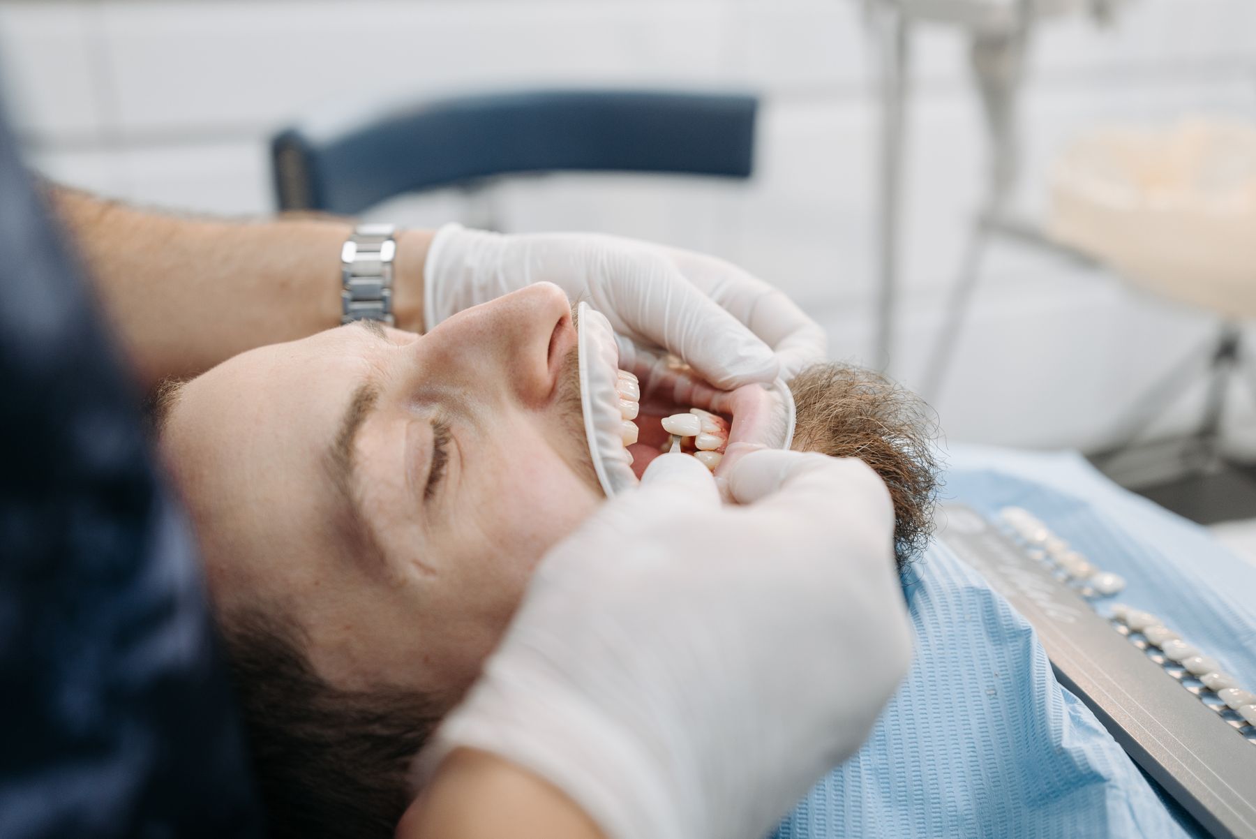 Dentist matching a dental crown shade to a patient's teeth with a shade guide