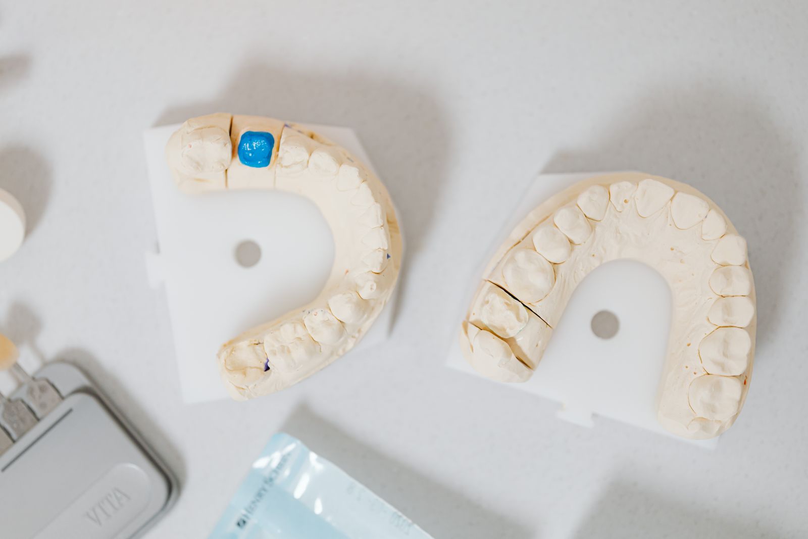 Dental cast models of teeth on a table, showing where a crown fits over a tooth