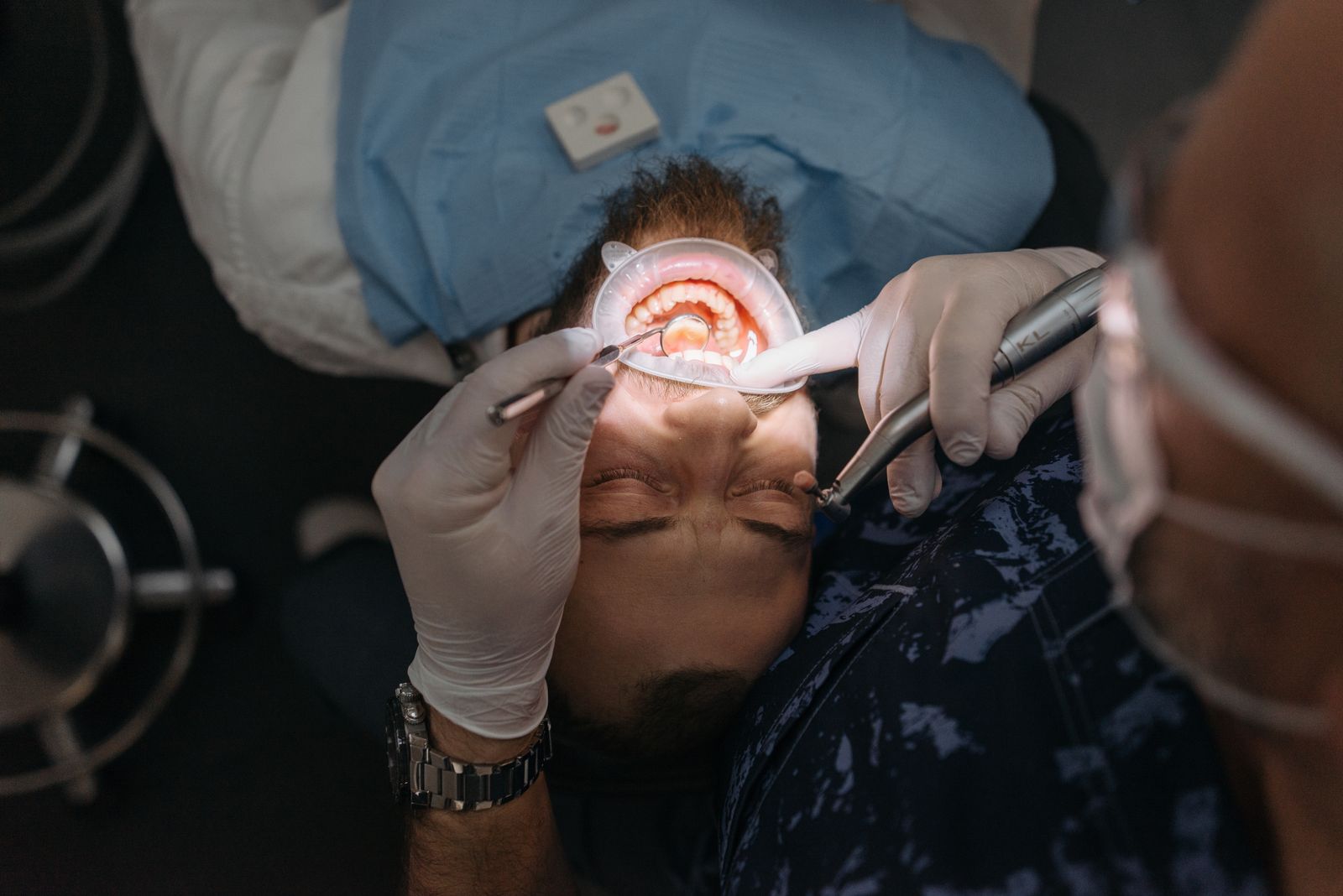 A dentist examining a patient's tooth at a check-up, where the choice between a deep filling and a root canal gets made
