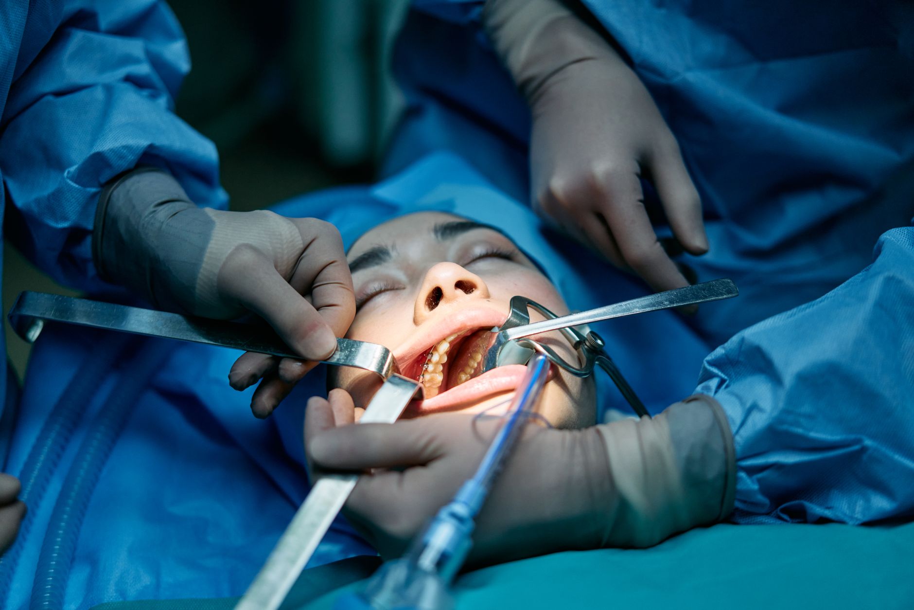 A dental team performing a tooth extraction on a patient in a clinic