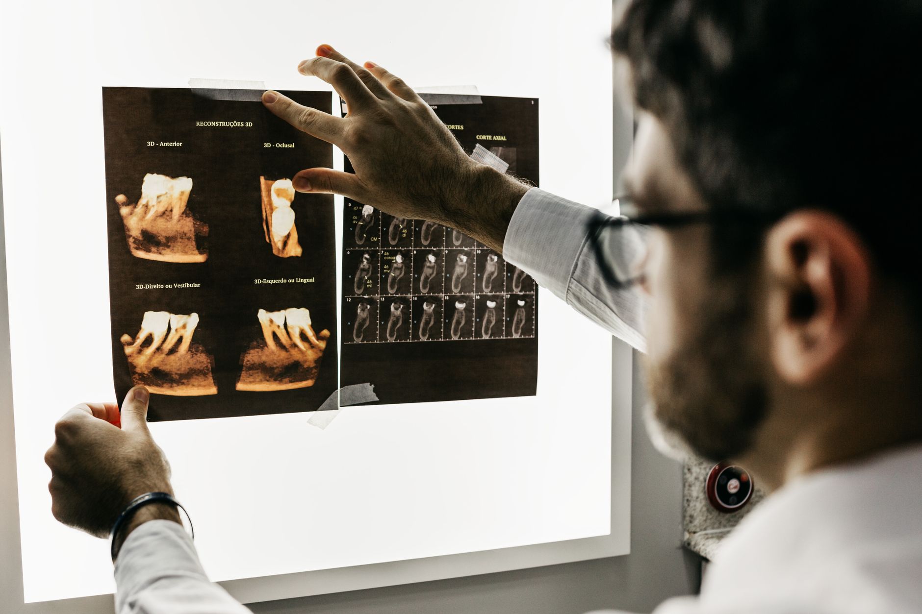 A dentist studying a patient's dental X-rays in a clinic