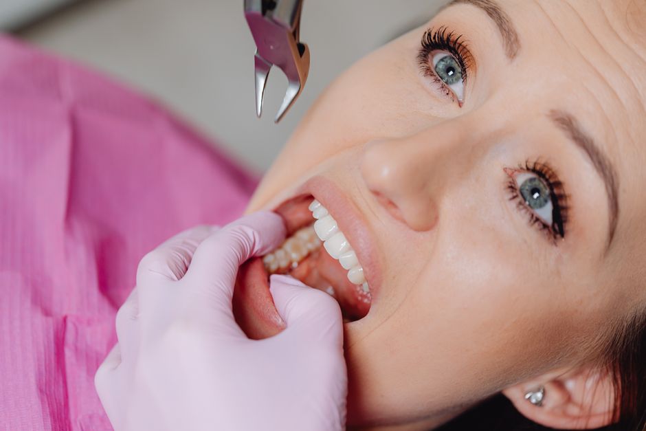 Patient undergoing a tooth extraction procedure