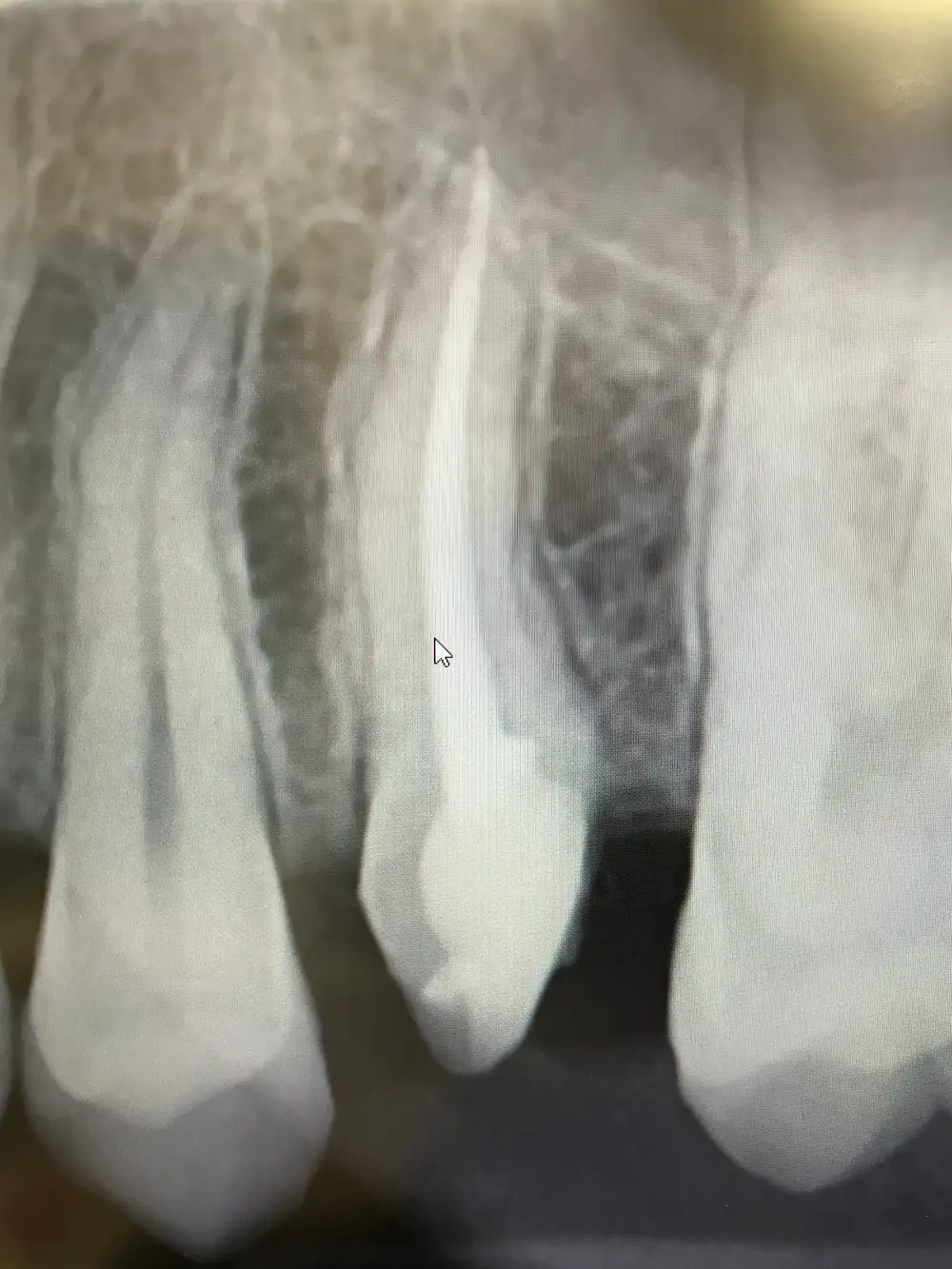 We save the tooth first