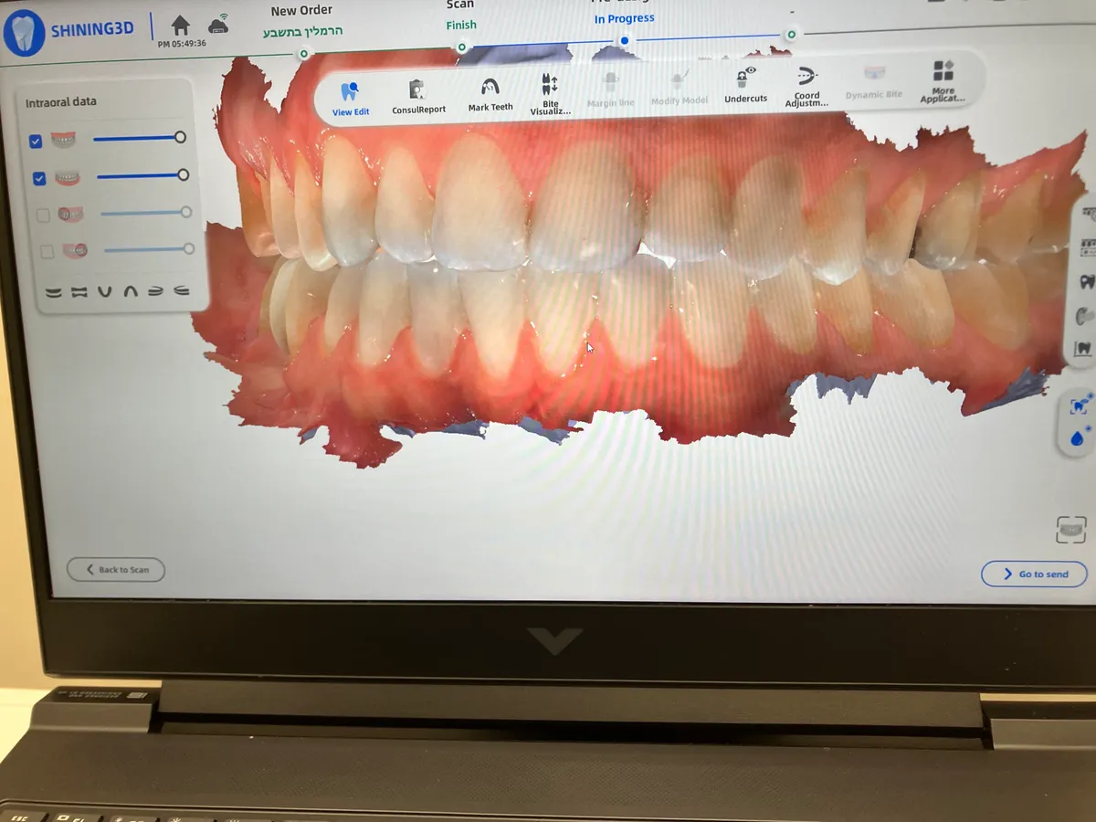 A digital 3D scan of a patient's teeth on the clinic's scanner screen.